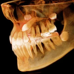 Tecnología Dentinova